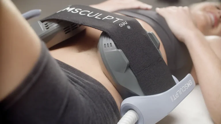 Emsculpt neo à Brive : réduire la graisse et renforcer les muscles