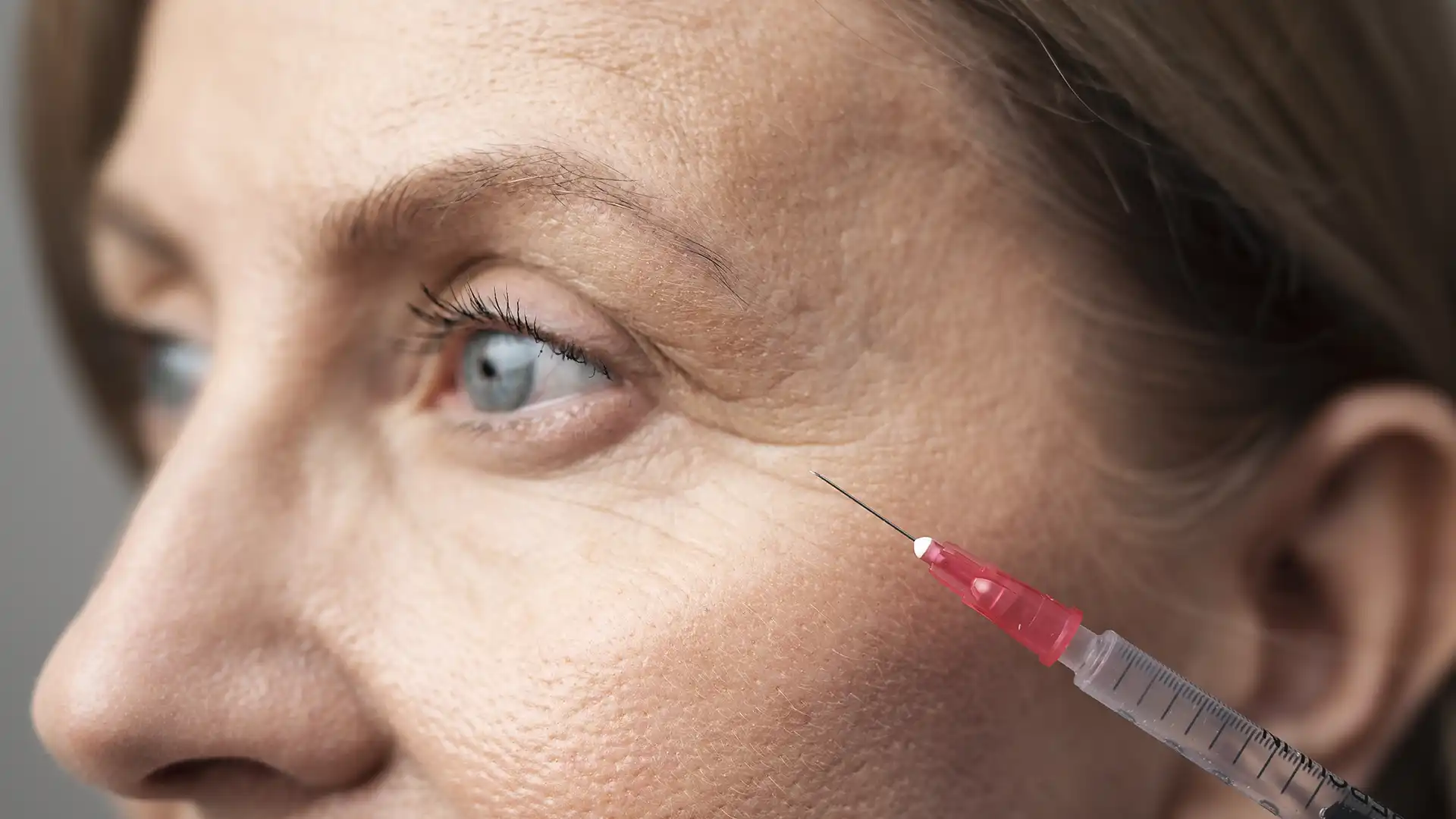Acide hyaluronique : quelles zones du visage peut-on traiter ?