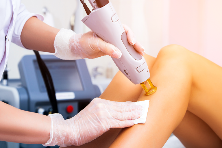 Épilation laser peau mate : Alexandrite ou Nd-Yag, quel laser choisir ?